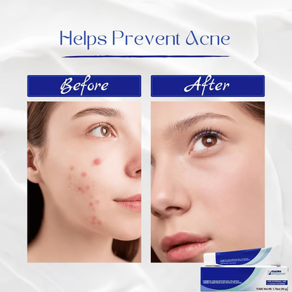 Top Sellers Duo: Vitamin A Pommade + Ialuset Hyaluronic Acid Anti-Wrinkle Cream