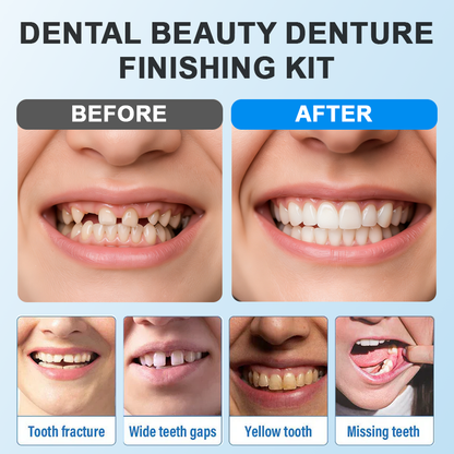 Moldable Dentures – Affordable, Comfortable & Easy At-Home Fit