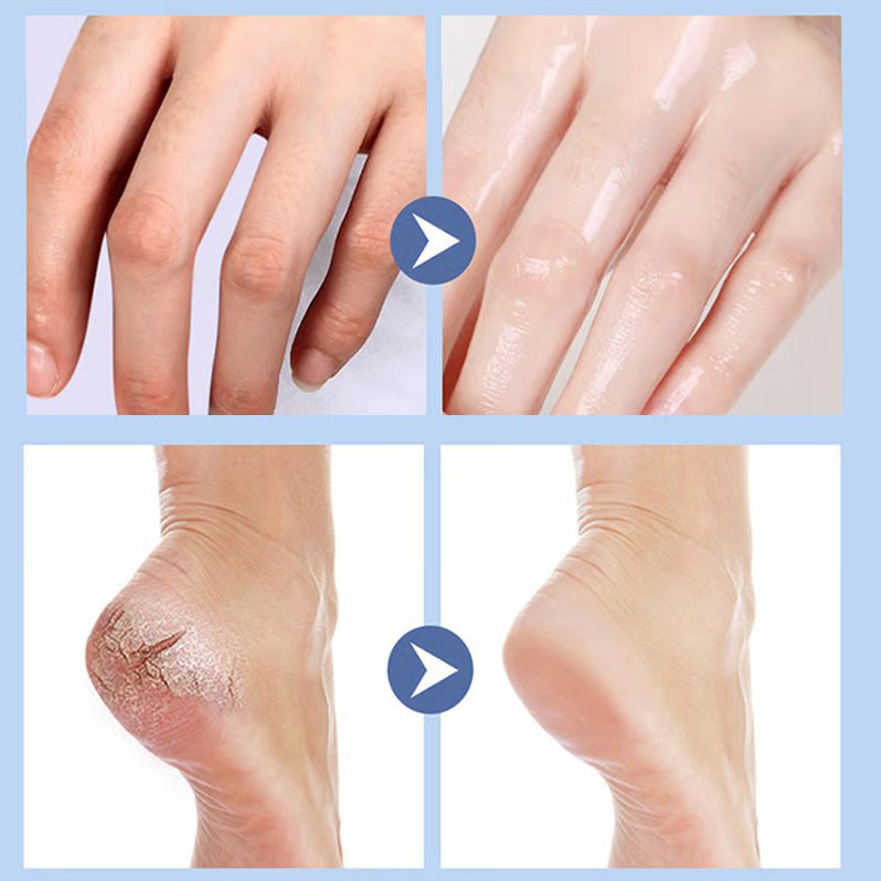 (Buy 1 Get 1 Free) Foot Care Cream-Set of 2